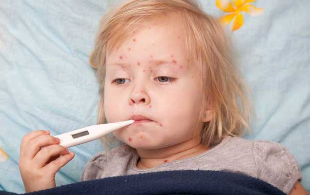 اومیکرون در کودکان باعث سرخک میشود