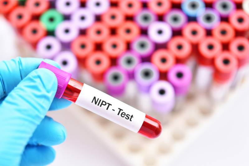آزمایش NIPT چیست؟ + اهمیت ان برای خانوم های باردار