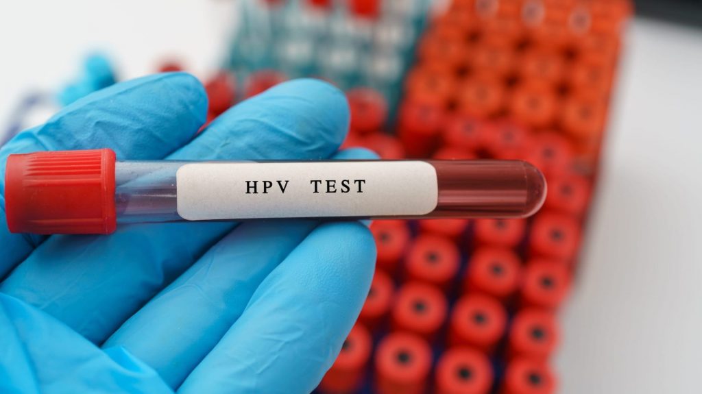 روش های درمان عفونت با ازمایش HPV