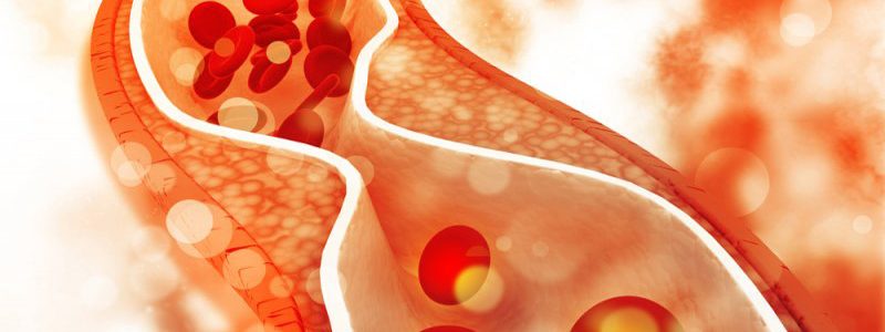 پیوند دیابت و چربی خون: یک رابطه دوطرفه