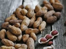 آزمایش کبد چرب