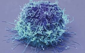 کبد چرب و فریتین بالا