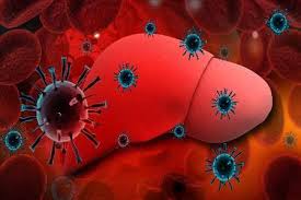 هپاتیت اتوایمیون