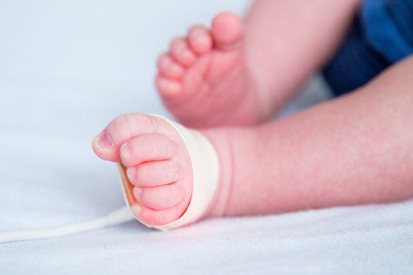 علت تکرار آزمایش کف پای نوزاد